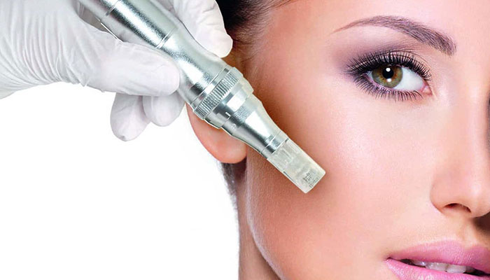 میکرونیدلینگ چیست و چه مزایایی دارد؟