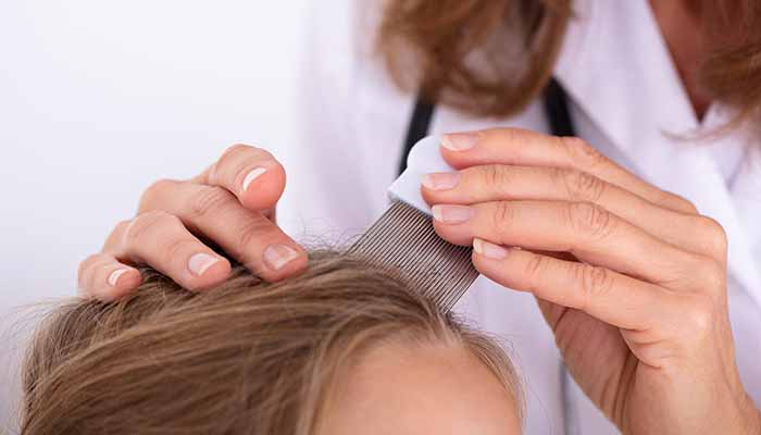 علت ریزش مو در کودکان و نحوه درمان